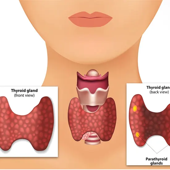 Parathyroid Hormone Disorders